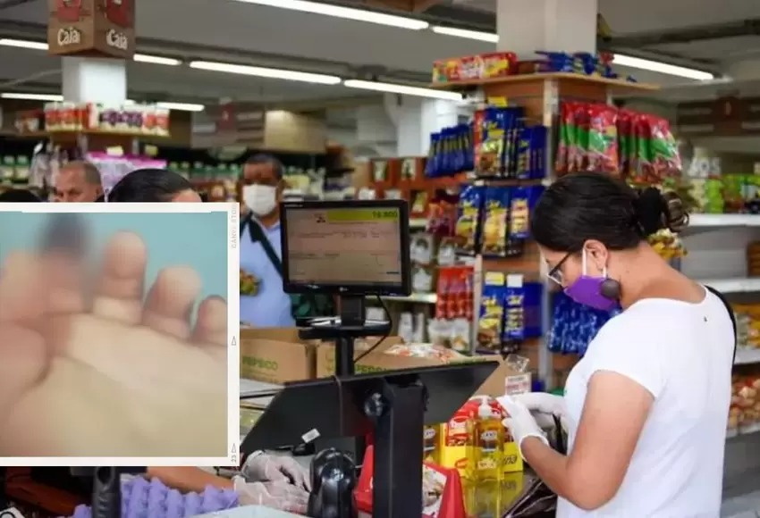 Terrible accidente: Niño de cinco años perdió un dedo en una banda transportadora de un supermercado