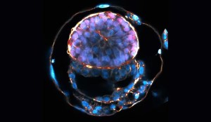 Cuatro claves del nuevo avance en la carrera por los embriones humanos sintéticos