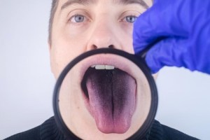 Qué significa tener la lengua con manchas o de otro color, según la Universidad de Harvard