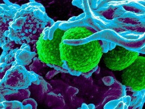Abuso de antibióticos: cómo es el plan contrarreloj para frenar a las superbacterias
