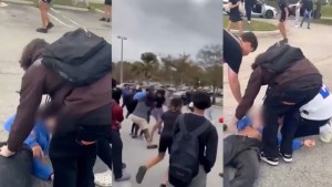Imágenes sensibles: Estudiantes golpearon brutalmente a joven en Florida y le causaron horrible lesión en el cráneo