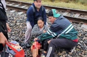Terrible accidente en México: Migrante venezolana casi pierde la pierna al intentar abordar un tren