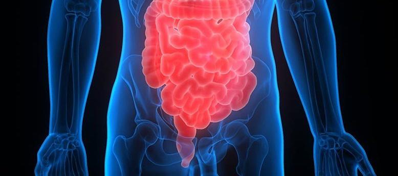 Los factores que impulsan el aumento de casos de cáncer de intestino en adultos