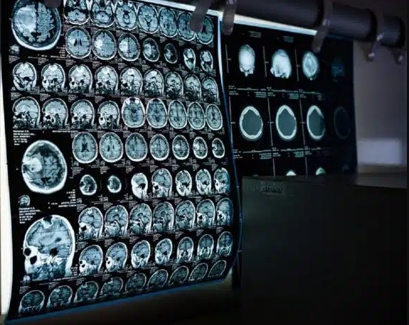 MRI prices in Caracas are reaching alarming numbers