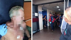 Sexagenario sobrevivió a la descarga de un cable de alta tensión que lo dejó suspendido en Zulia