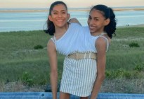 Las gemelas siamesas Carmen y Lupita revelan cómo sienten cuando tienen relaciones y qué pasará cuando una muera
