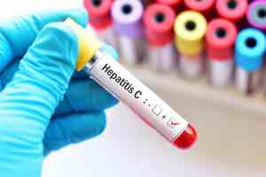 La mortalidad por hepatitis viral aumenta en el mundo por limitado acceso a diagnósticos y tratamiento