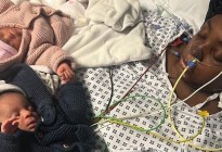 Madre sufrió amputación de manos y piernas tras dar a luz a gemelos